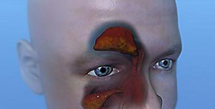 Пазухи носа