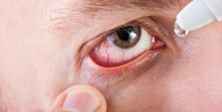 Закапывание глаза