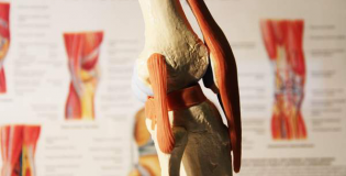 Артрит коленного сустава