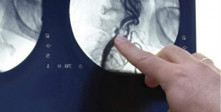 Снимок позвоночника