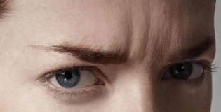 Морщины в межбровной зоне