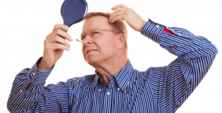 Лысеющий мужчина