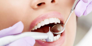 Лечение зубов