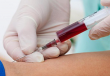 анализ крови из вены
