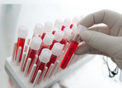Исследование крови