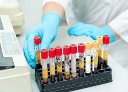 Анализ крови Анализ крови