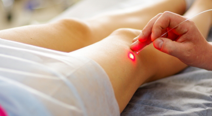 лазерная коагуляция вен лазерная коагуляция вен