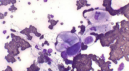 изменение состава крови изменение состава крови