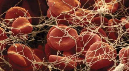 фибрин фибрин