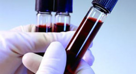 пониженный RDW пониженный RDW