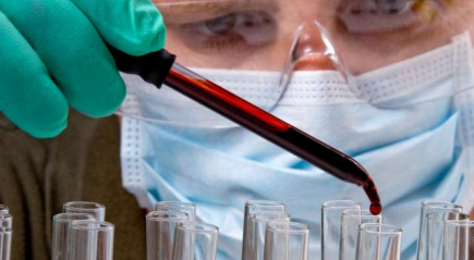 Анализ крови Анализ крови