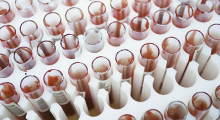 пробы на аллергены пробы на аллергены