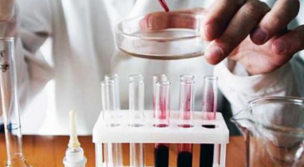 Лабораторное исследование крови Лабораторное исследование крови