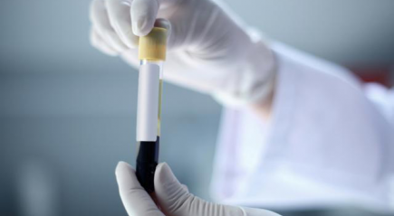 Бробирка с кровью Бробирка с кровью