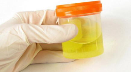 исследование мочи