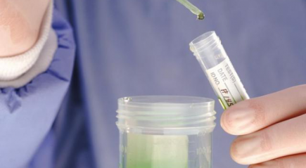 Исследование мочи белок Исследование мочи белок