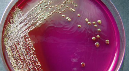 Escherichia coli Escherichia coli