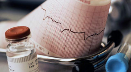 Результат ЭКГ