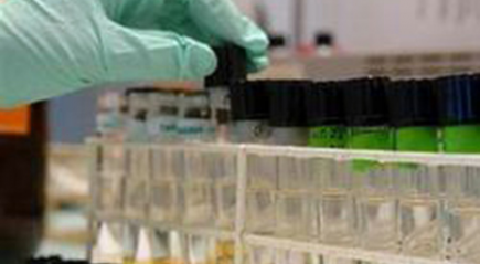 анализ мочи анализ мочи