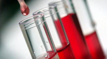 Бробирки с анализами