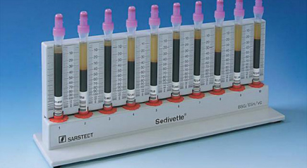 оседание эритроцитов оседание эритроцитов