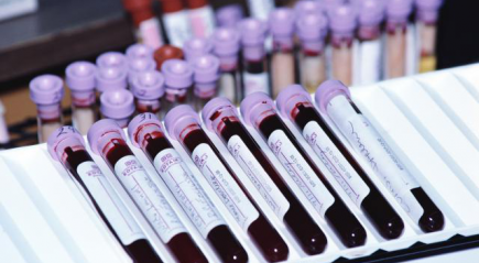 Анализы крови в лаборатории Анализы крови в лаборатории