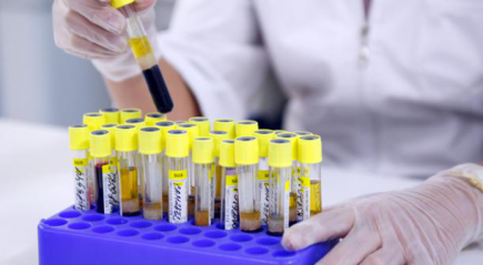 Анализ крови Анализ крови