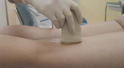 Исследование сосудов ног