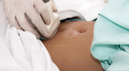 Ультразвуковое исследование Ультразвуковое исследование