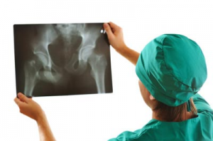 снимок тазобедренного сустава снимок тазобедренного сустава