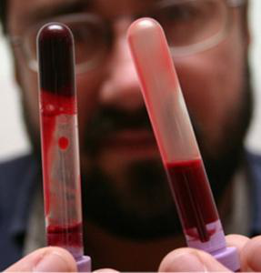 густая кровь