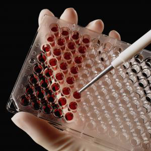 как сдать анализ крови