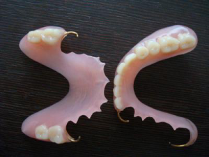 Пластиночные протезы Пластиночные протезы