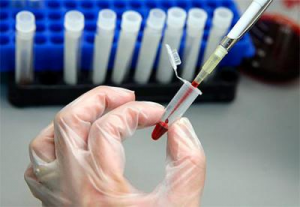 исследование крови