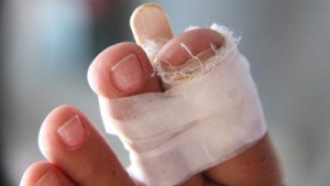 Наложенная шина Наложенная шина