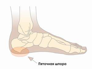 Шпора