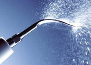 Ультразвуковая чистка зубов Ультразвуковая чистка зубов