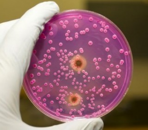 кандидоз кандидоз