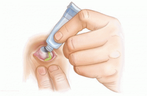мазь для глаз мазь для глаз