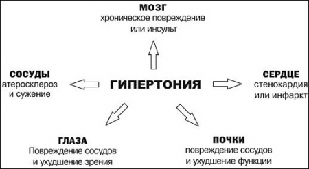 гипертония
