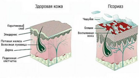 кожа