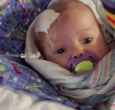 Киста головного мозга у новорожденного Киста головного мозга у новорожденного