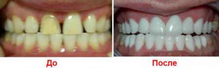 До и после До и после