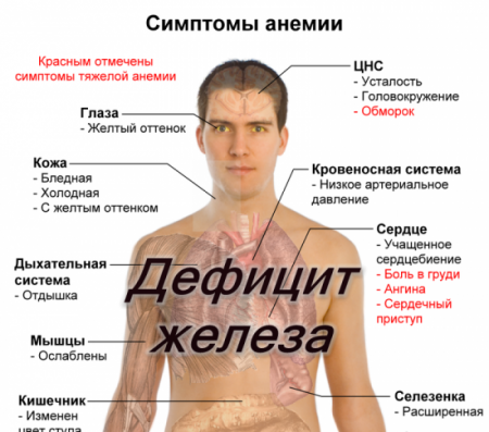Дефицит железа симптомы