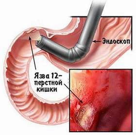 Эндоскопия Эндоскопия