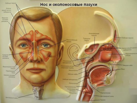 гайморит