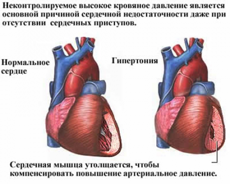 серце