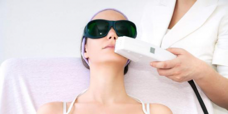Эпиляция лица лазером