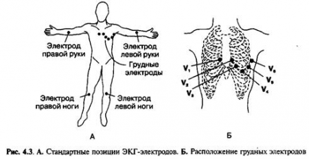 Стандартные отведения ЭКГ Стандартные отведения ЭКГ