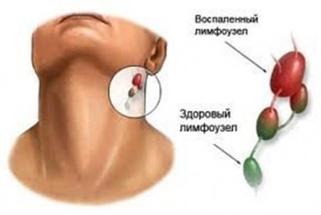 Лимфоузлы